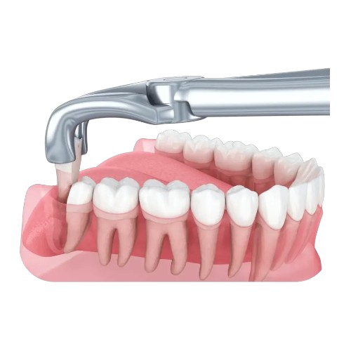 Стоматологические материалы хирургия Украина в интернет-магазине NewDental